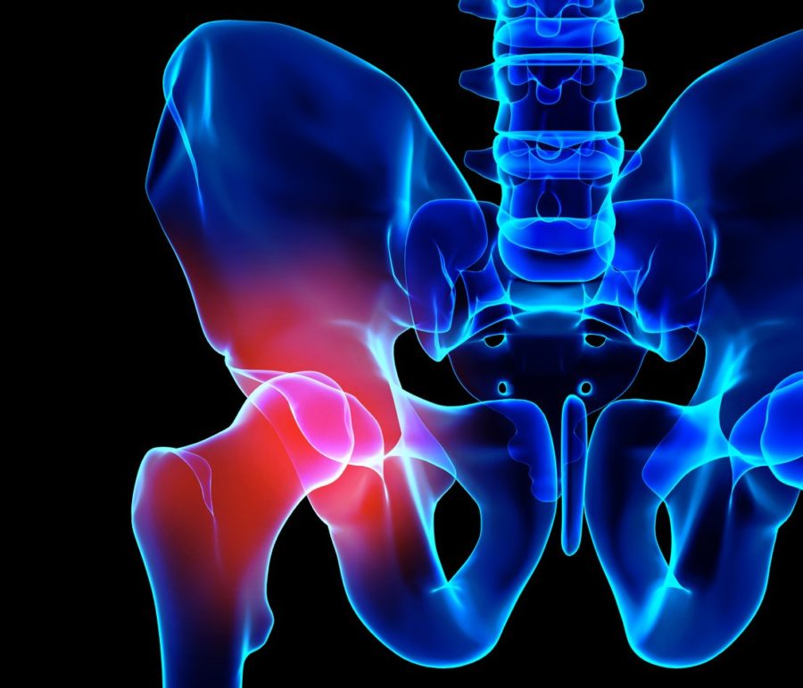 hip labral tear with pain down leg