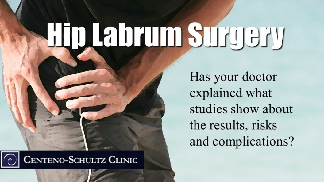 what you're getting with hip labrum surgery