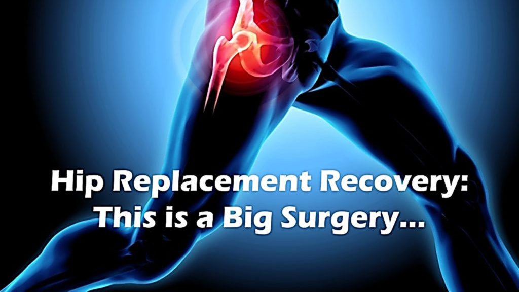 Hip Replacement Recovery What To Know & What To Expect