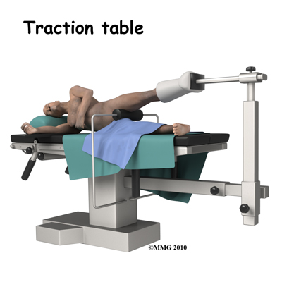 Treatment for Hip Labral Tears - Orthagenex