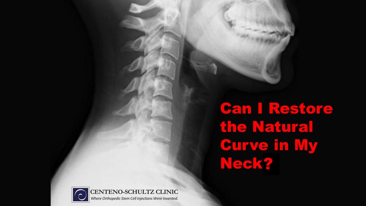 how to restore natural curve in your neck