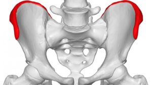 Iliac crest outlined in RED - Iliac crest pain