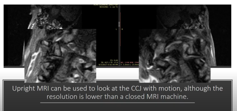 mri resolution clearview