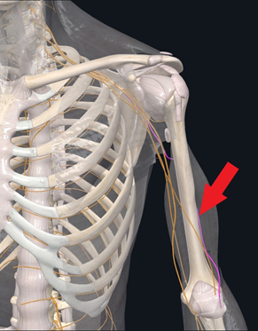 location of radial nerve palsy - radial nerve