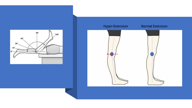 A) Range of motion of the ankle joint: maximum plantar flexion (70