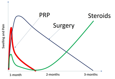 PRP Recovery vs Surgery & Steroids