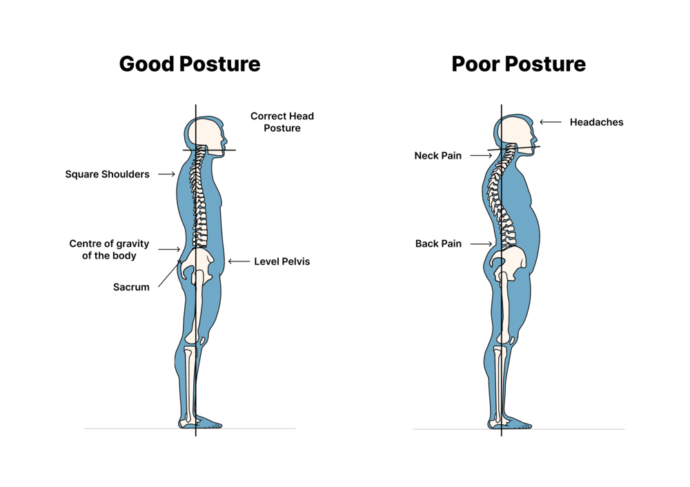 Don't Ignore These Neck Pain Causes – Centeno-Schultz Clinic