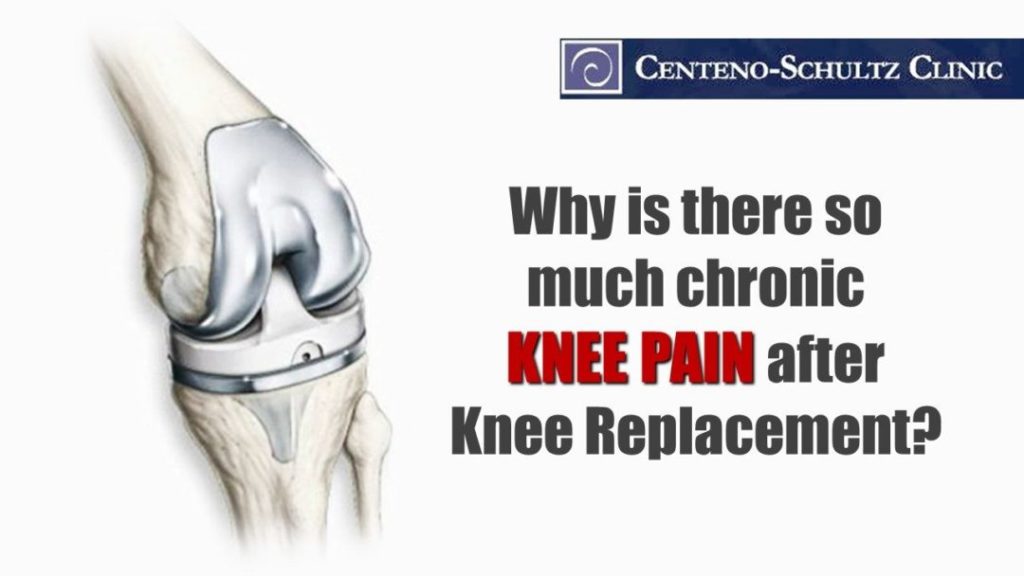 can you travel 8 weeks after knee replacement