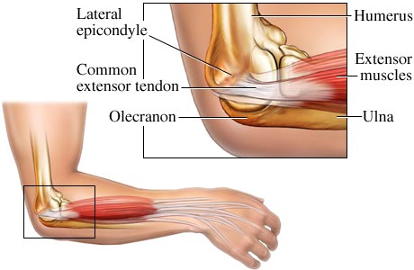 lateral-epicondyle