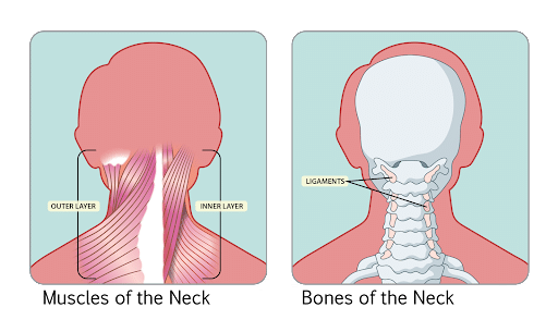 https://centenoschultz.com/wp-content/uploads/location-of-neck-stiffness.png