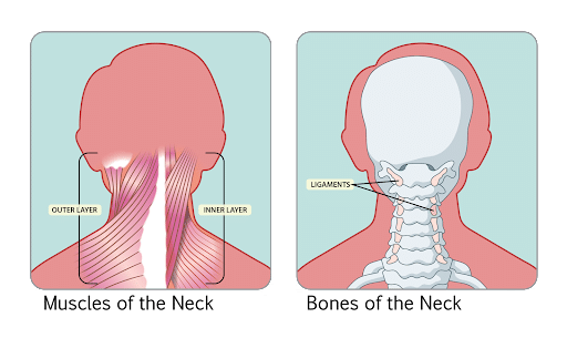 Stiff Neck Relief With Remedial Massage