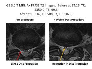 Lonnies MRI axial