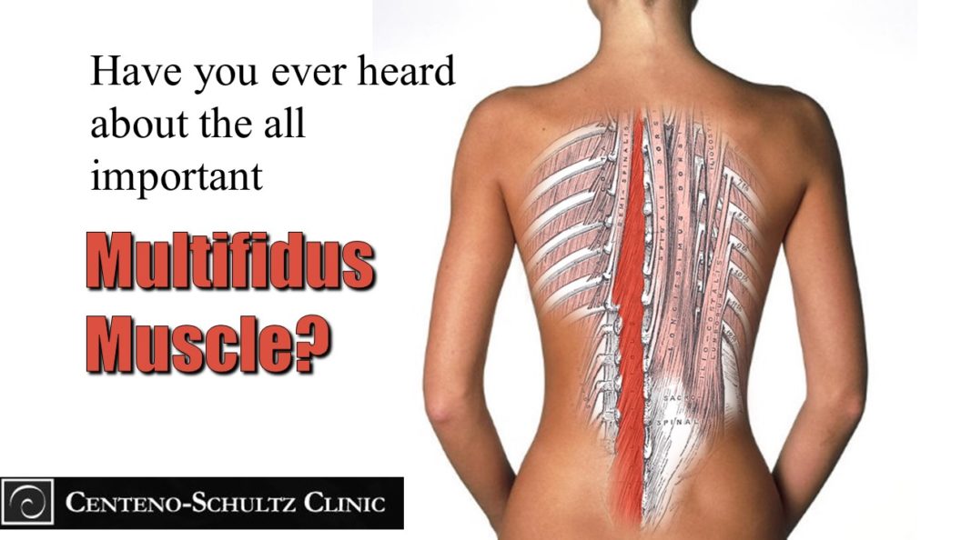 Breaking Down Multifidus Muscle Pain: Causes and Symptoms