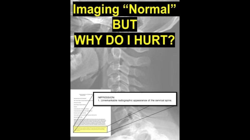 neck pain but your imaging is normal