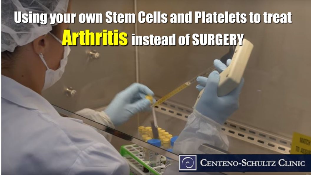 orthobiologics to treat arthritis