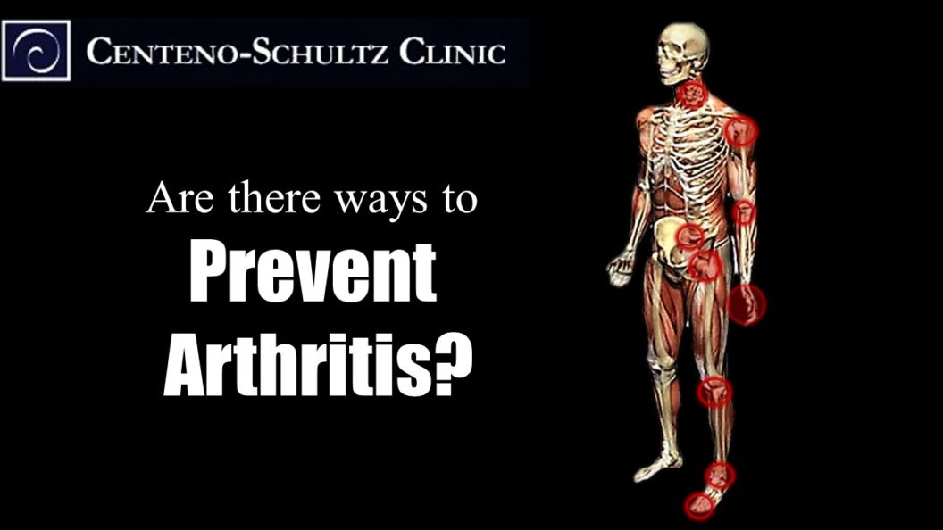 prevent arthritis