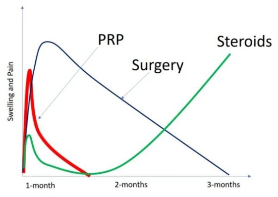 PRP v Streroid Shots & Surgery