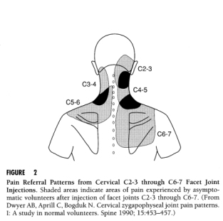 referral pattern of cervical facet