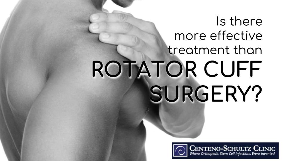 rotator cuff tear surgery