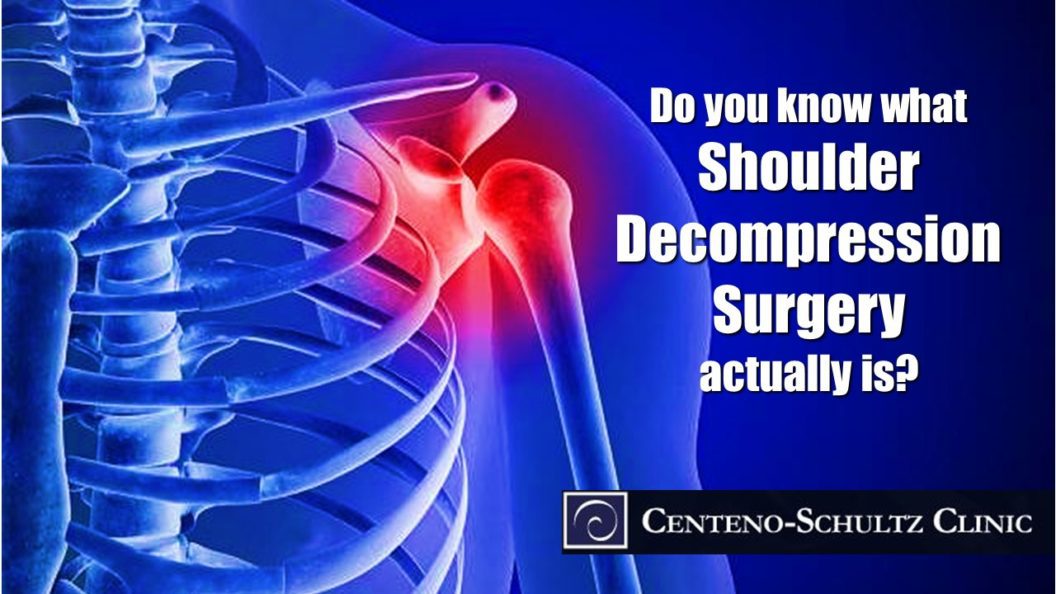 shoulder decompression surgery
