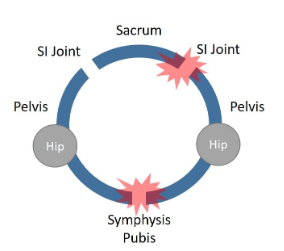 Osteitis Pubis: Causes & Treatment Insights