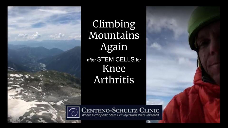 stem cells for knee arthritis