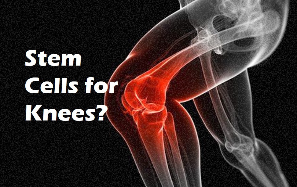 stem cells for knees