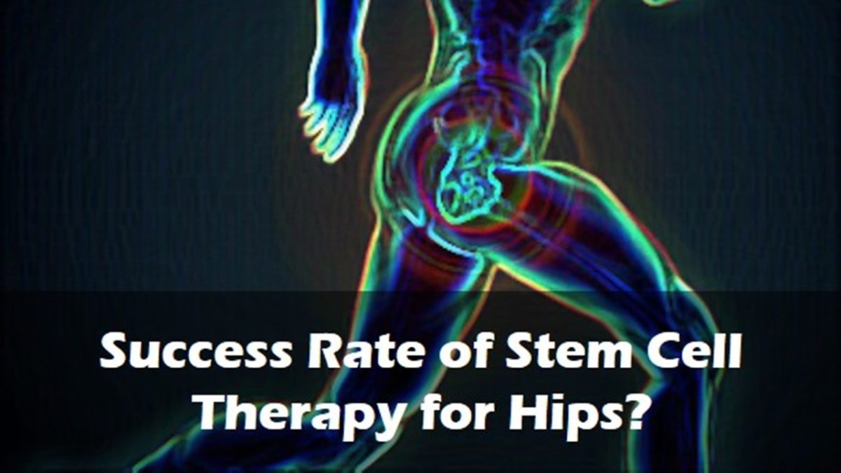 Success Rate of Stem Cell Therapy for Hips? CentenoSchultz