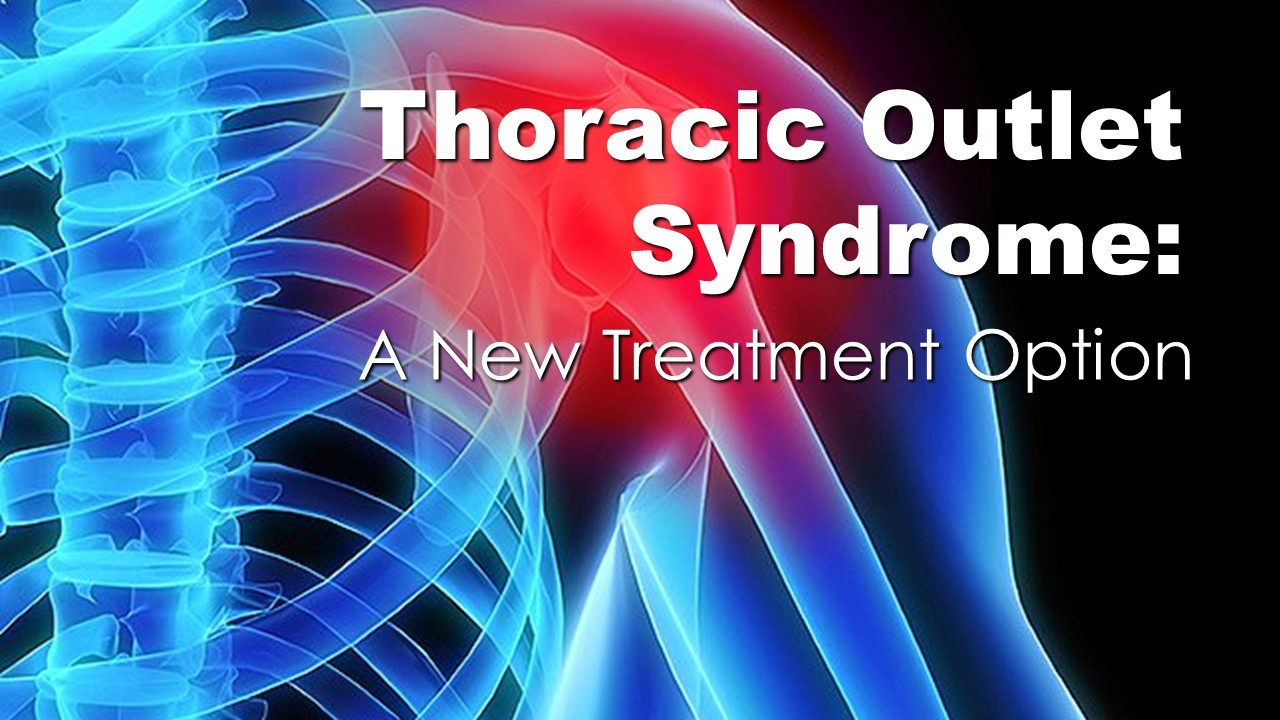 thoriacic outlet syndrome a new treatment option