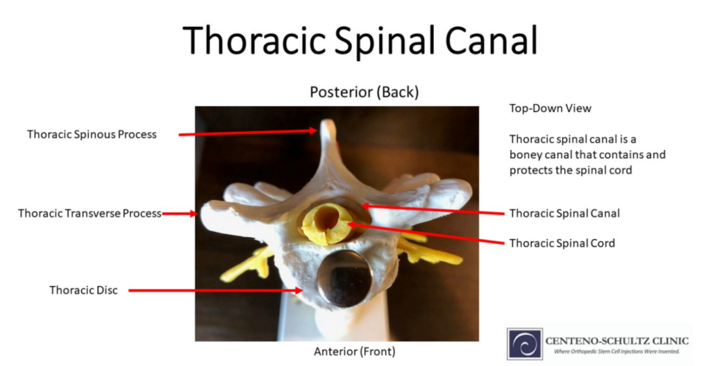 Thoracic spinal canal