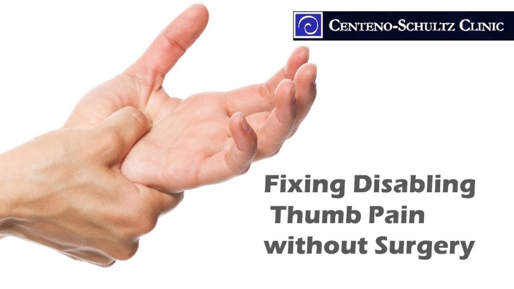 thumb pain and arthritis