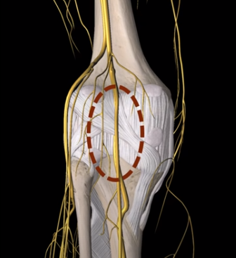 tibial nerve may the source of pain in the back of the knee