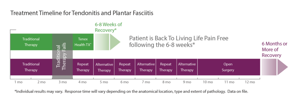 Treatment Timeline with Tenex Procedure