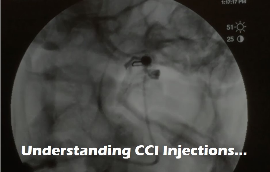 understanding CCI injections