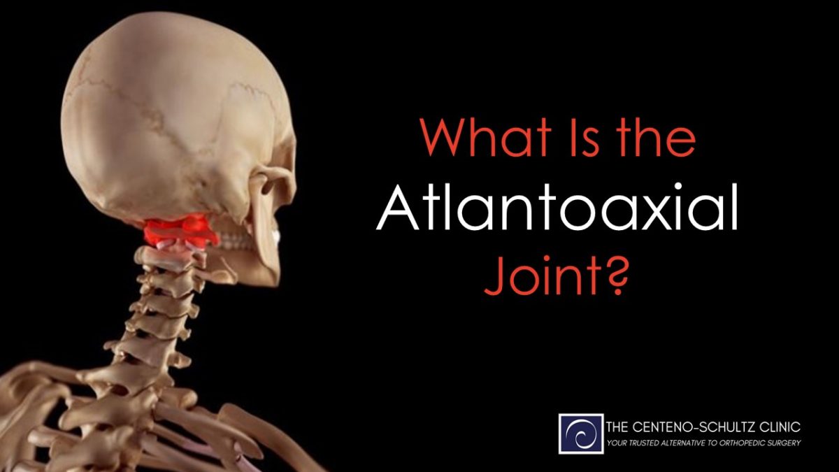 What Is the Atlantoaxial Joint? - Centeno-Schultz Clinic